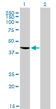 Western blot - Anti-TDP43 antibody [2E2-D3] (ab57105), expandable thumbnail