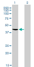 Western blot - Anti-TDP43 antibody [2E2-D3] (AB57105)