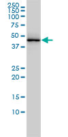 Western blot - Anti-TDP43 antibody [2E2-D3] (AB57105), expandable thumbnail