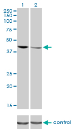 Western blot - Anti-TDP43 antibody [2E2-D3] (ab57105), expandable thumbnail