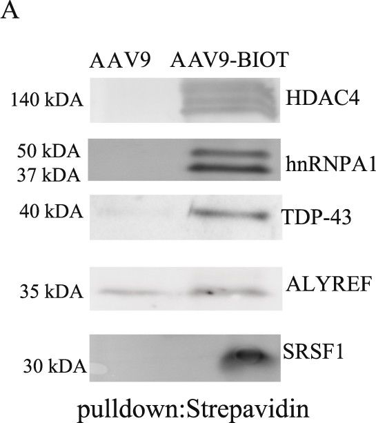 Western blot - Anti-TDP43 antibody [2E2-D3] (ab57105), expandable thumbnail