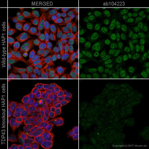 Immunocytochemistry/ Immunofluorescence - Anti-TDP43 antibody [3H8] (AB104223), expandable thumbnail