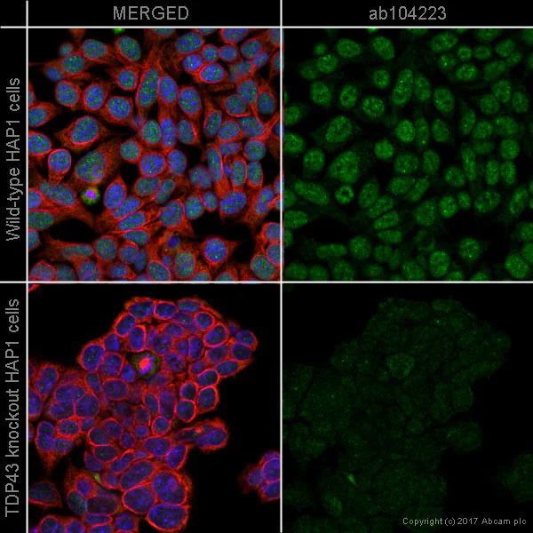 Immunocytochemistry/ Immunofluorescence - Anti-TDP43 antibody [3H8] (AB104223)