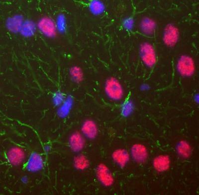 Immunocytochemistry/ Immunofluorescence - Anti-TDP43 antibody [3H8] (AB104223), expandable thumbnail