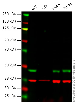 Western blot - Anti-TDP43 antibody [3H8] (AB104223), expandable thumbnail