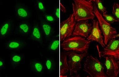 Immunocytochemistry/ Immunofluorescence - Anti-TDP43 antibody (AB154047)