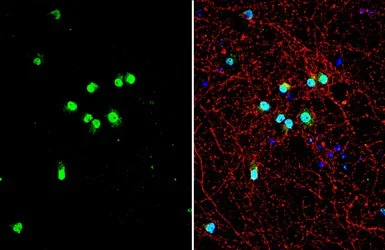 Immunocytochemistry/ Immunofluorescence - Anti-TDP43 antibody (AB154047)