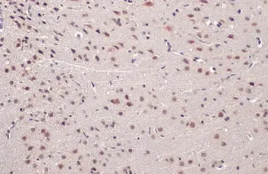 Immunohistochemistry (Formalin/PFA-fixed paraffin-embedded sections) - Anti-TDP43 antibody (AB154047)