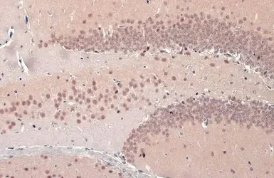 Immunohistochemistry (Formalin/PFA-fixed paraffin-embedded sections) - Anti-TDP43 antibody (AB154047)