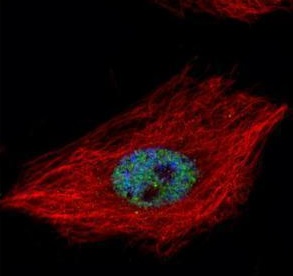Immunocytochemistry/ Immunofluorescence - Anti-TDP43 antibody (AB183752), expandable thumbnail