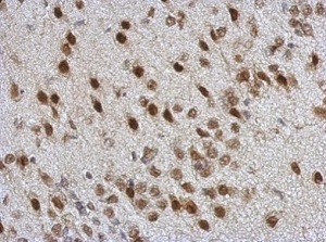 Immunohistochemistry (Formalin/PFA-fixed paraffin-embedded sections) - Anti-TDP43 antibody (AB183752), expandable thumbnail