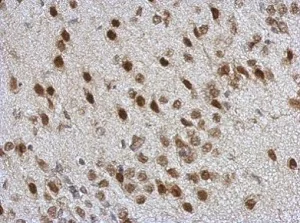 Immunohistochemistry (Formalin/PFA-fixed paraffin-embedded sections) - Anti-TDP43 antibody (AB183752)