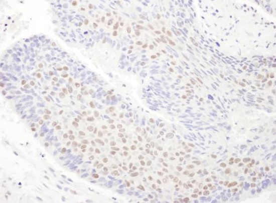 Immunohistochemistry (Formalin/PFA-fixed paraffin-embedded sections) - Anti-TDP43 antibody (AB225710), expandable thumbnail