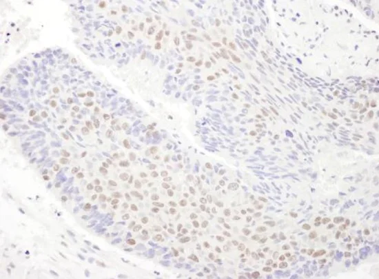 Immunohistochemistry (Formalin/PFA-fixed paraffin-embedded sections) - Anti-TDP43 antibody (AB225710)