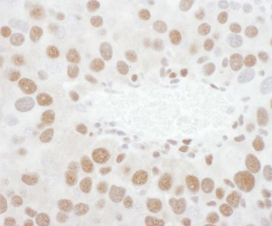 Immunohistochemistry (Formalin/PFA-fixed paraffin-embedded sections) - Anti-TDP43 antibody (AB225710), expandable thumbnail