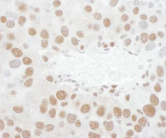 Immunohistochemistry (Formalin/PFA-fixed paraffin-embedded sections) - Anti-TDP43 antibody (AB225710)