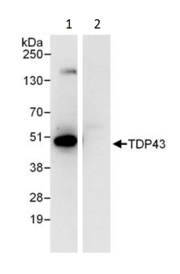 Immunoprecipitation - Anti-TDP43 antibody (AB225710), expandable thumbnail