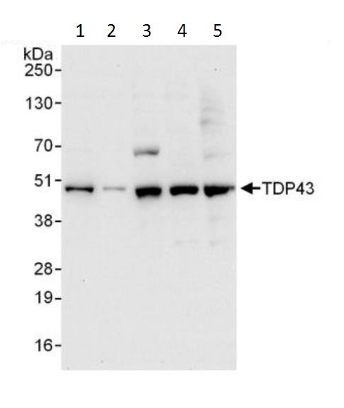 Western blot - Anti-TDP43 antibody (AB225710), expandable thumbnail