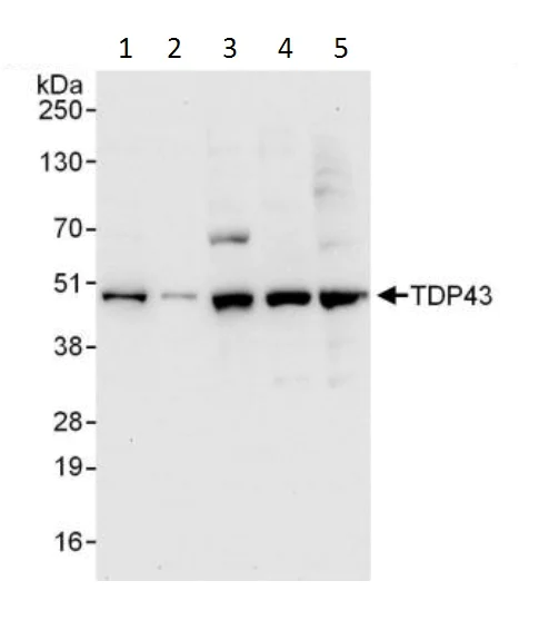 Western blot - Anti-TDP43 antibody (AB225710)