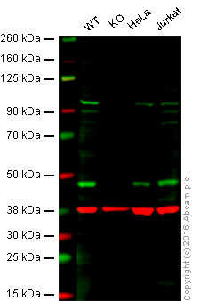 Western blot - Anti-TDP43 antibody (AB41881), expandable thumbnail