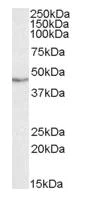 Western blot - Anti-TDP43 antibody (AB80608)