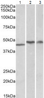 Western blot - Anti-TDP43 antibody (AB80608), expandable thumbnail