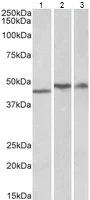 Western blot - Anti-TDP43 antibody (AB80608)