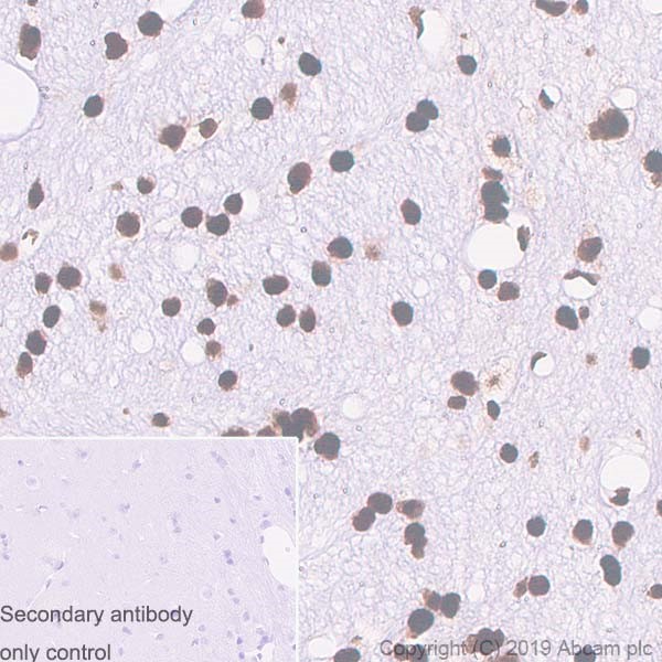 Immunohistochemistry (Formalin/PFA-fixed paraffin-embedded sections) - Anti-TDP43 antibody [DB9] (AB254166), expandable thumbnail
