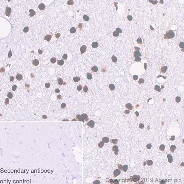 Immunohistochemistry (Formalin/PFA-fixed paraffin-embedded sections) - Anti-TDP43 antibody [DB9] (AB254166)