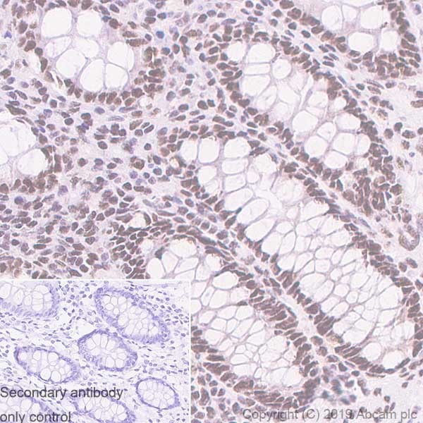 Immunohistochemistry (Formalin/PFA-fixed paraffin-embedded sections) - Anti-TDP43 antibody [DB9] (AB254166), expandable thumbnail