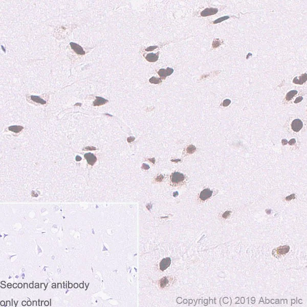 Immunohistochemistry (Formalin/PFA-fixed paraffin-embedded sections) - Anti-TDP43 antibody [DB9] (AB254166)