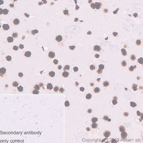 Immunohistochemistry (Formalin/PFA-fixed paraffin-embedded sections) - Anti-TDP43 antibody [DB9] (AB254166)