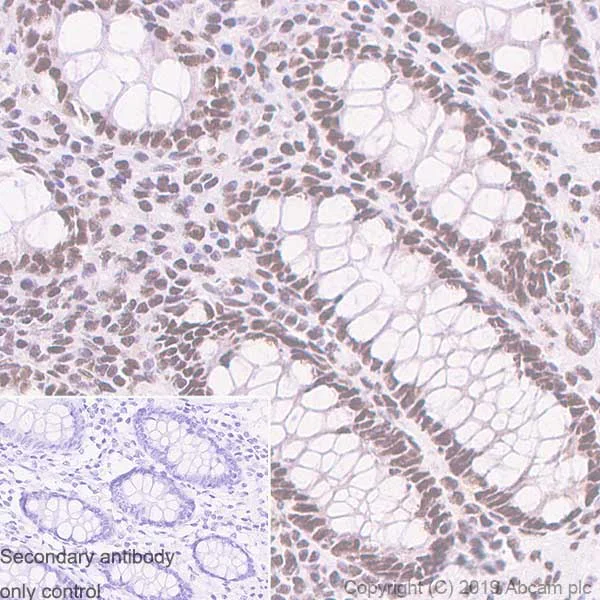 Immunohistochemistry (Formalin/PFA-fixed paraffin-embedded sections) - Anti-TDP43 antibody [DB9] - BSA and Azide free (AB255922)