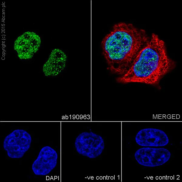Immunocytochemistry/ Immunofluorescence - Anti-TDP43 antibody [EPR18554] (AB190963)