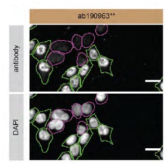 Immunocytochemistry/ Immunofluorescence - Anti-TDP43 antibody [EPR18554] (ab190963), expandable thumbnail