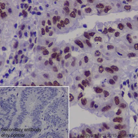 Immunohistochemistry (Formalin/PFA-fixed paraffin-embedded sections) - Anti-TDP43 antibody [EPR18554] (AB190963)