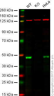 Western blot - Anti-TDP43 antibody [EPR18554] (AB190963), expandable thumbnail