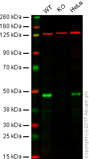 Western blot - Anti-TDP43 antibody [EPR18554] (AB190963)