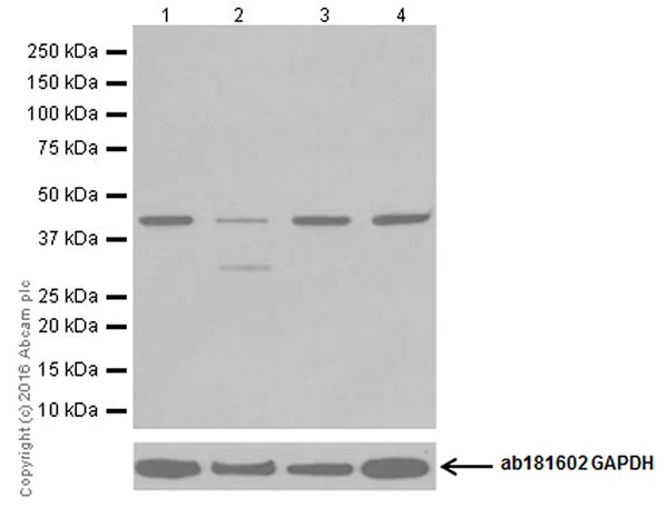 Western blot - Anti-TDP43 antibody [EPR18554] (AB190963)