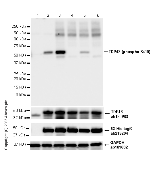 Western blot - Anti-TDP43 antibody [EPR18554] (ab190963), expandable thumbnail