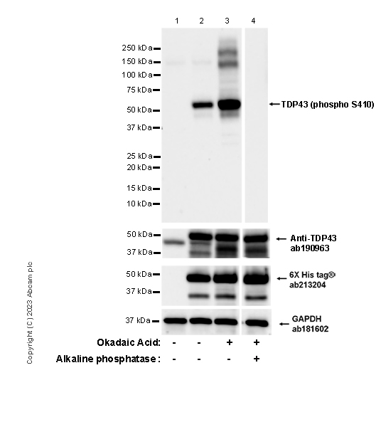 Western blot - Anti-TDP43 antibody [EPR18554] (ab190963), expandable thumbnail