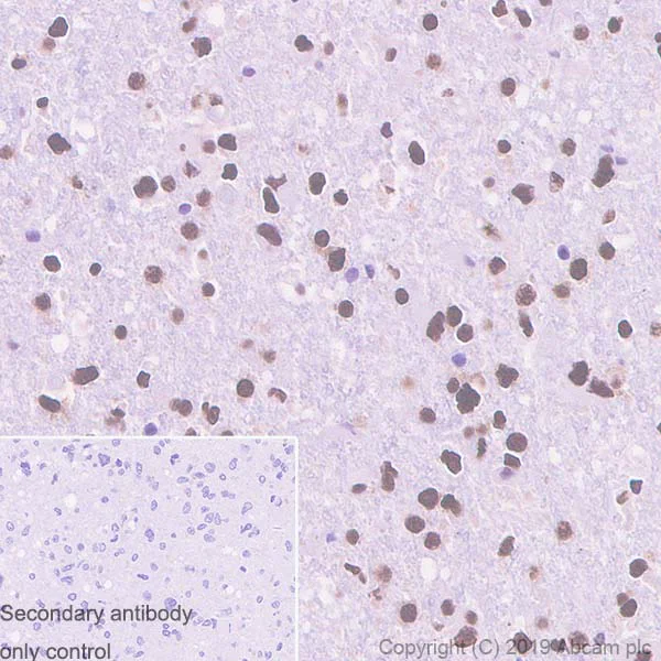 Immunohistochemistry (Formalin/PFA-fixed paraffin-embedded sections) - Anti-TDP43 antibody [EPR5810] (AB109535)