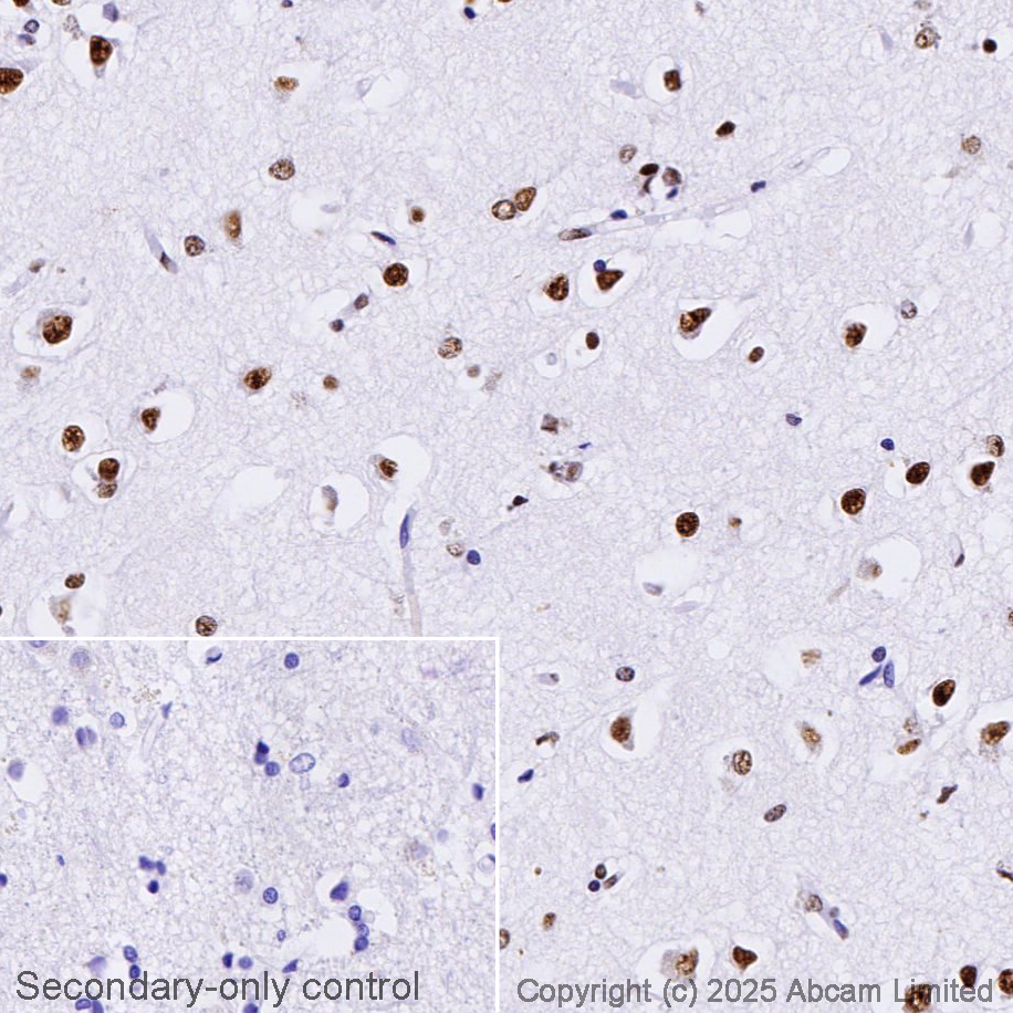 Immunohistochemistry (Formalin/PFA-fixed paraffin-embedded sections) - Anti-TDP43 antibody [EPR5810] (AB109535)