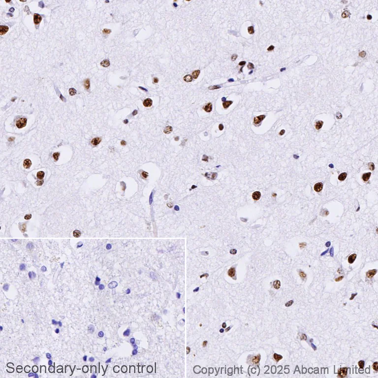 Immunohistochemistry (Formalin/PFA-fixed paraffin-embedded sections) - Anti-TDP43 antibody [EPR5810] (AB109535)
