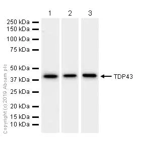 Western blot - Anti-TDP43 antibody [EPR5810] (AB109535)