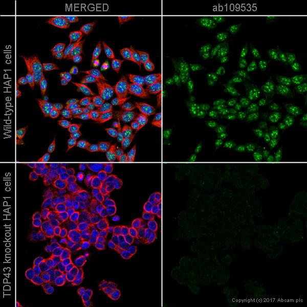 Immunocytochemistry/ Immunofluorescence - Anti-TDP43 antibody [EPR5810] - BSA and Azide free (ab185133), expandable thumbnail