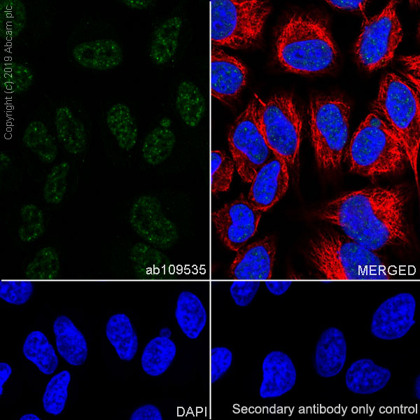 Immunocytochemistry/ Immunofluorescence - Anti-TDP43 antibody [EPR5810] - BSA and Azide free (AB185133), expandable thumbnail