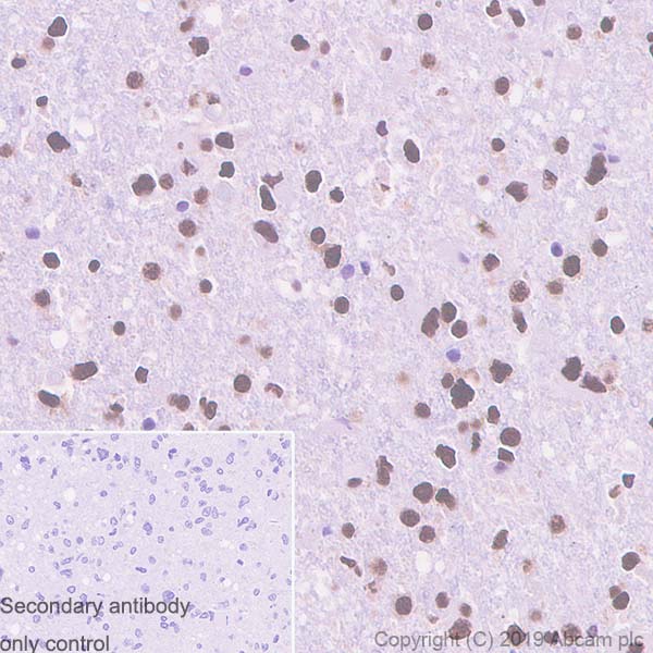 Immunohistochemistry (Formalin/PFA-fixed paraffin-embedded sections) - Anti-TDP43 antibody [EPR5810] - BSA and Azide free (ab185133), expandable thumbnail