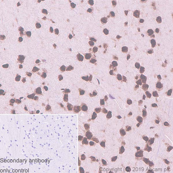 Immunohistochemistry (Formalin/PFA-fixed paraffin-embedded sections) - Anti-TDP43 antibody [EPR5810] - BSA and Azide free (ab185133), expandable thumbnail