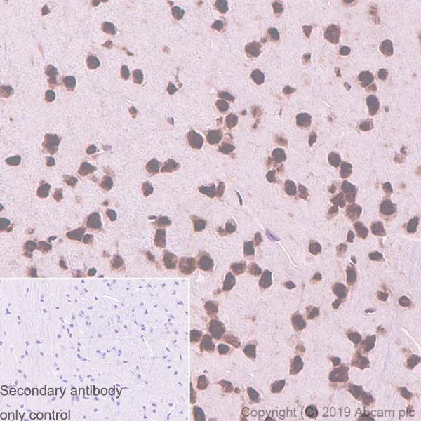 Immunohistochemistry (Formalin/PFA-fixed paraffin-embedded sections) - Anti-TDP43 antibody [EPR5810] - BSA and Azide free (AB185133)